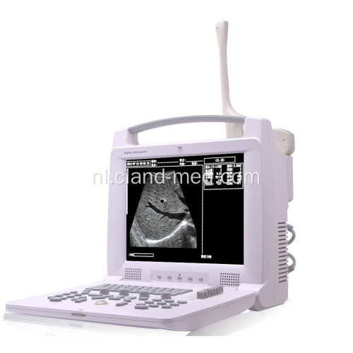 Draagbare Laptop Ultrasound Scanner Ultrasound Machine Prijs